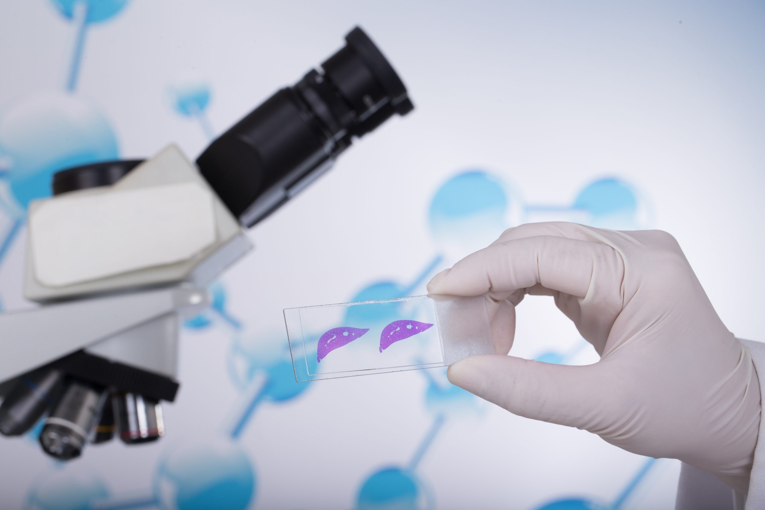 tissue biopsy