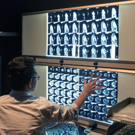 Teleradiology