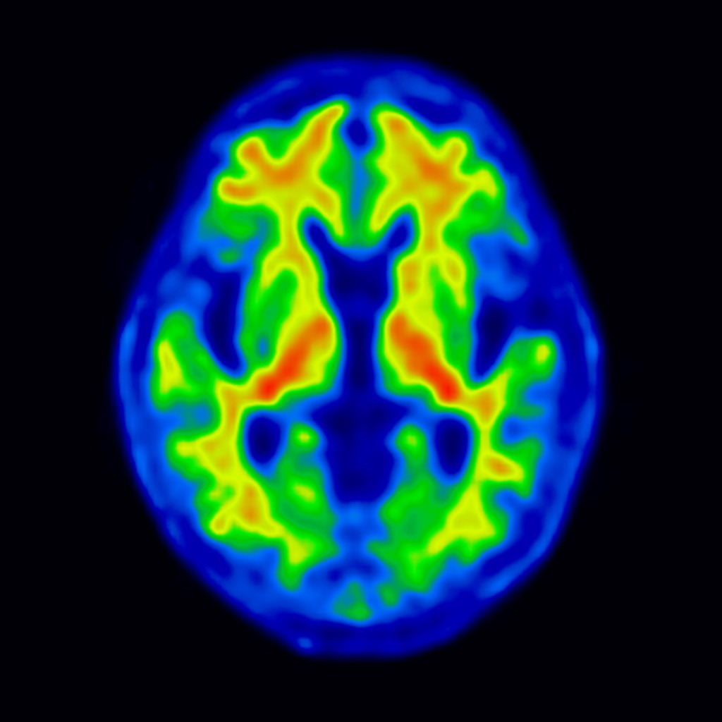 nuclear medicine