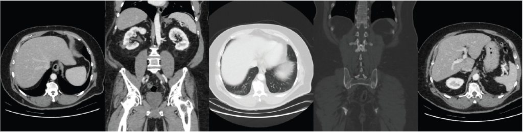 brain and spinal cord mri scan