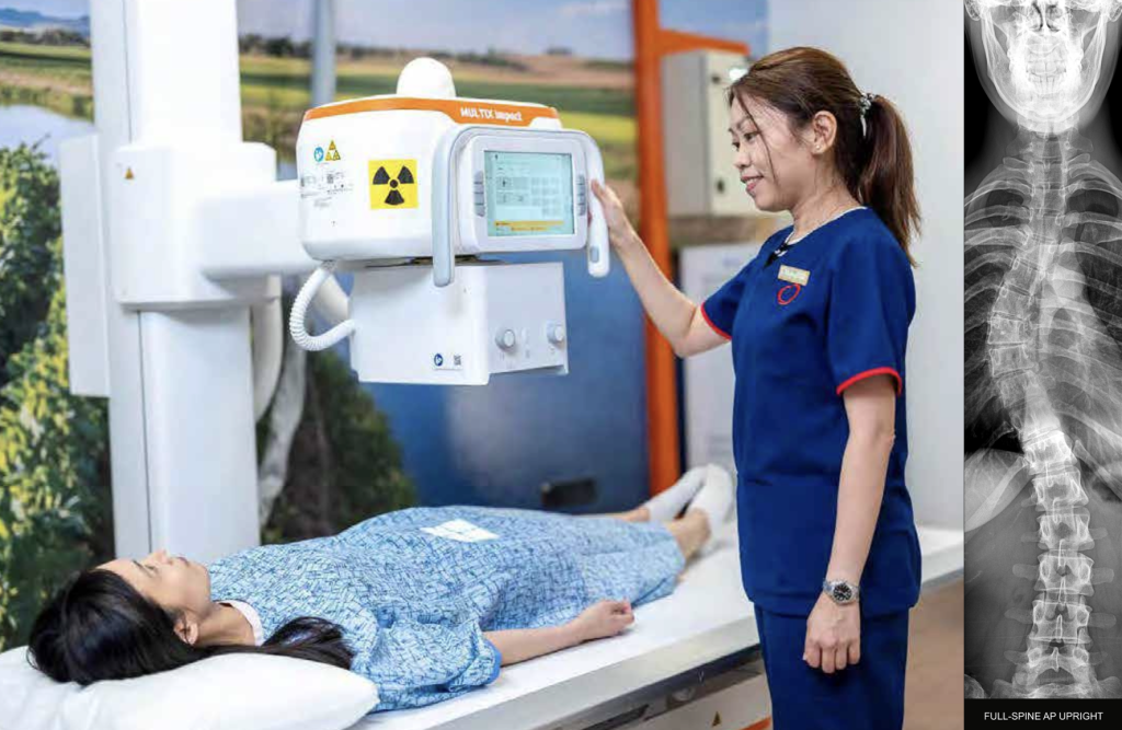 RadLink Camden X-Ray Machine with Long-film Xray